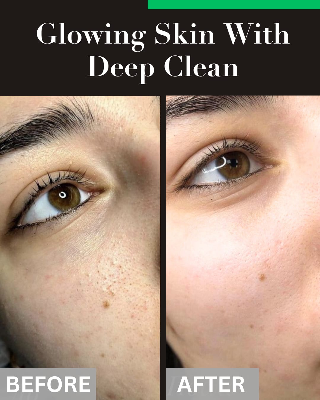 Glowing Skin With Deep Clean