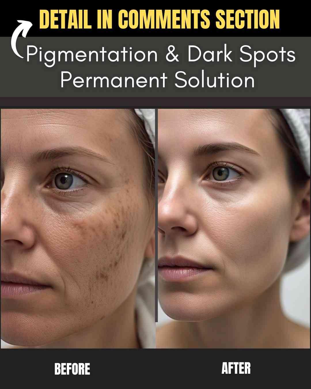 Pigmentation & Dark Spots Permanent Solution