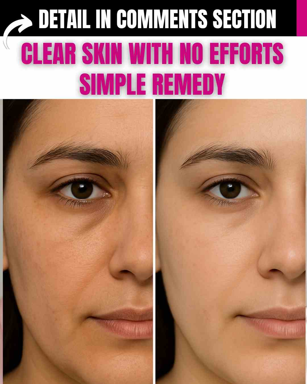 CLEAR SKIN WITH NO EFFORTS – SIMPLE REMEDY FOR ALL SKIN TYPES