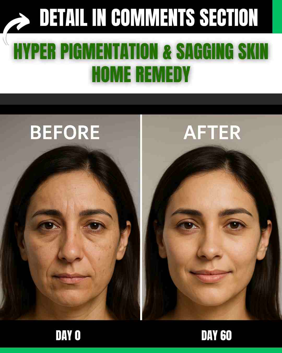 HYPER PIGMENTATION & SAGGING SKIN HOME REMEDY
