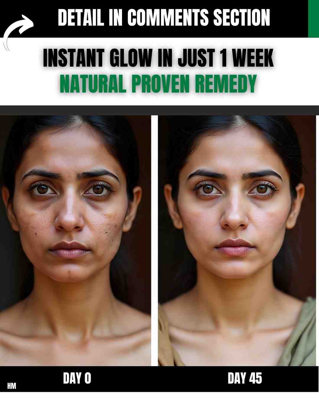 INSTANT GLOW IN JUST 1 WEEK – NATURAL PROVEN REMEDY
