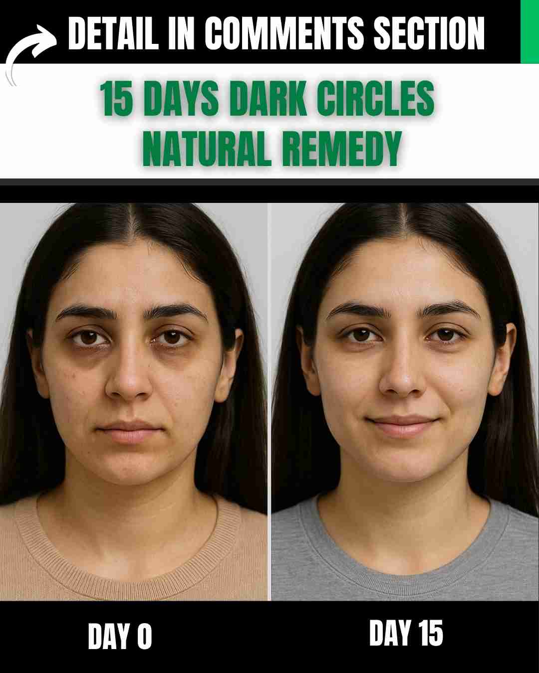 15 Days Dark Circles Natural Remedy with Diet Plan