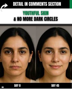 Youthful Skin & No More Dark Circles