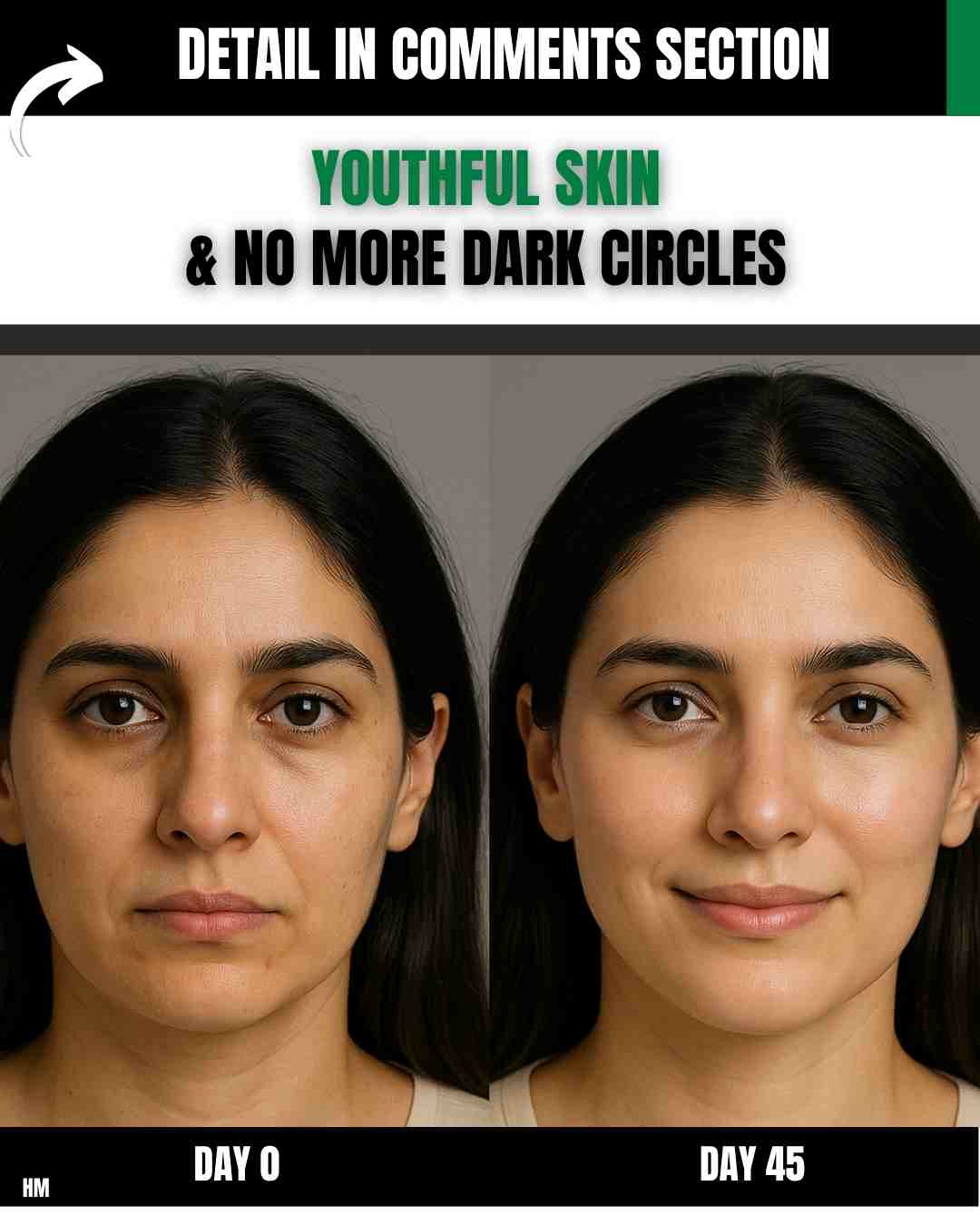 Dark circles, dull skin, and early signs of aging often make you look tired and older than you are. These issues are triggered by stress, poor sleep, dehydration, nutrient deficiencies, and excessive sun exposure.