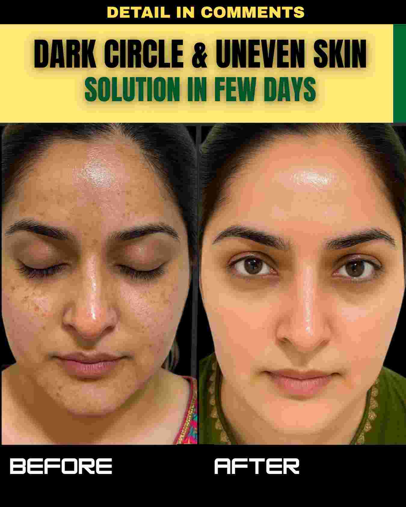 DARK CIRCLES AND UNEVEN SKIN – VISIBLE SOLUTION IN FEW DAYS
