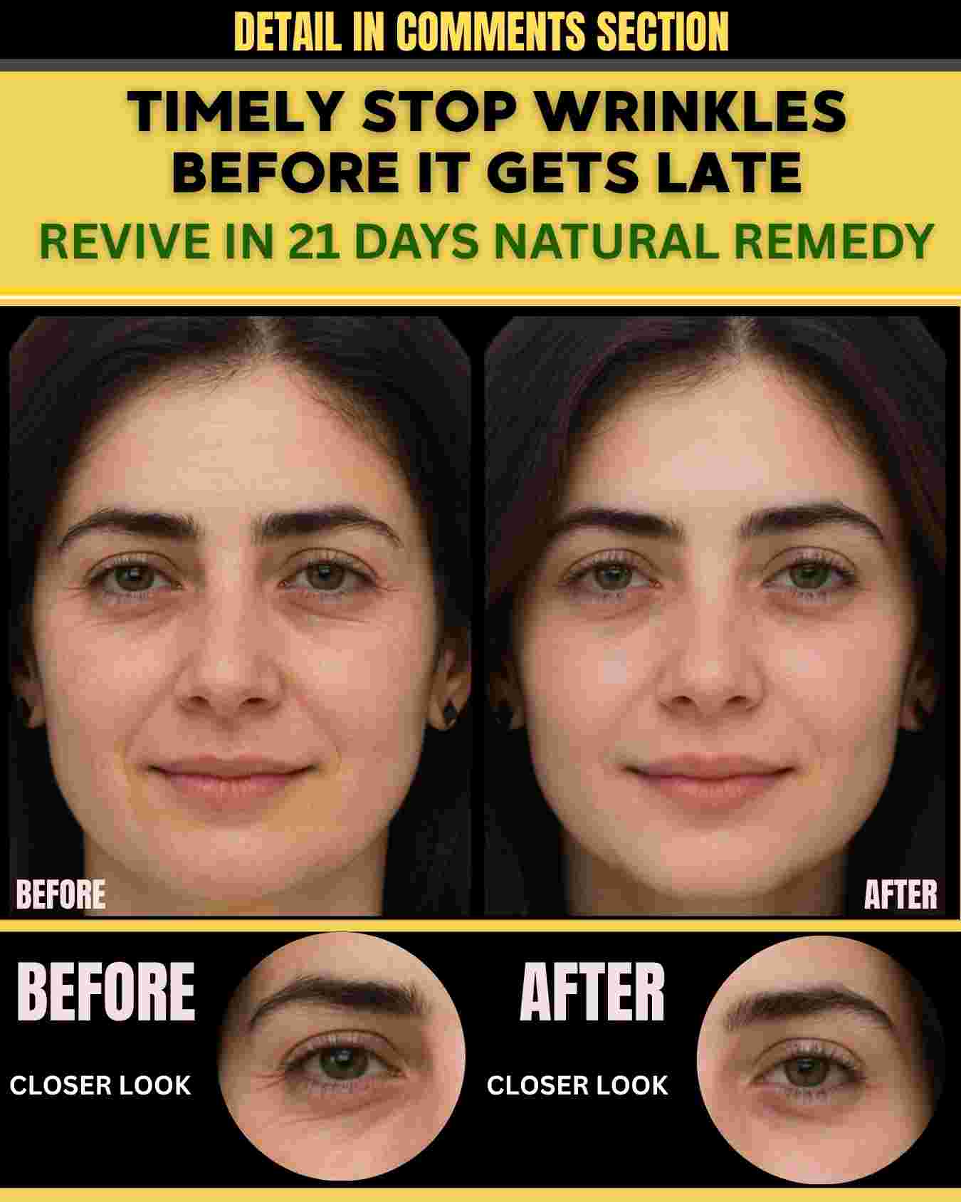 TIMELY STOP WRINKLES — BEFORE IT GETS LATE REVIVE IN 21 DAYS NATURAL REMEDY