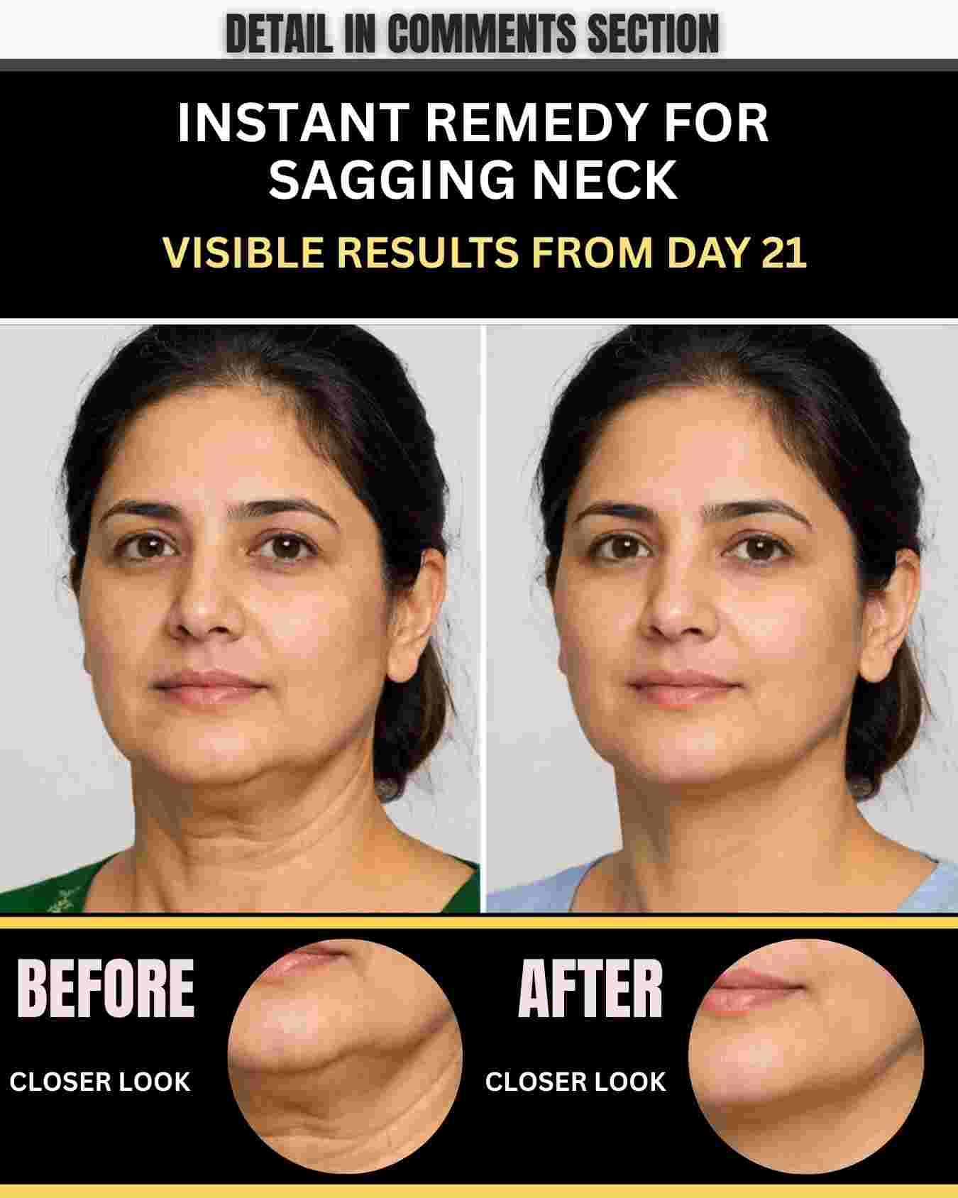 INSTANT REMEDY FOR SAGGING NECK