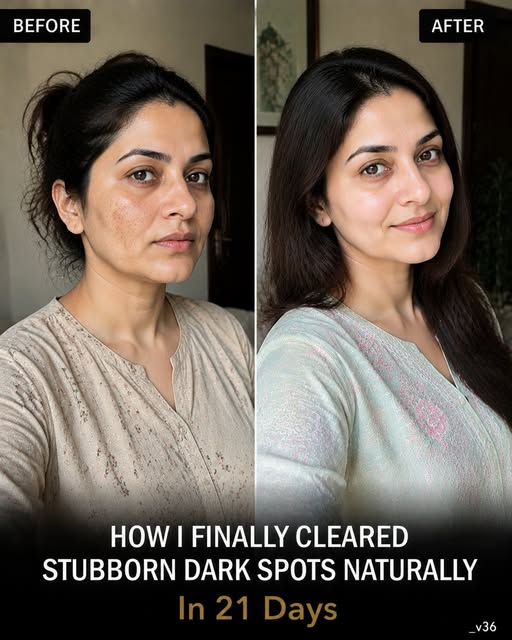 How I Finally Cleared Stubborn Dark Spots Naturally in 21 Days