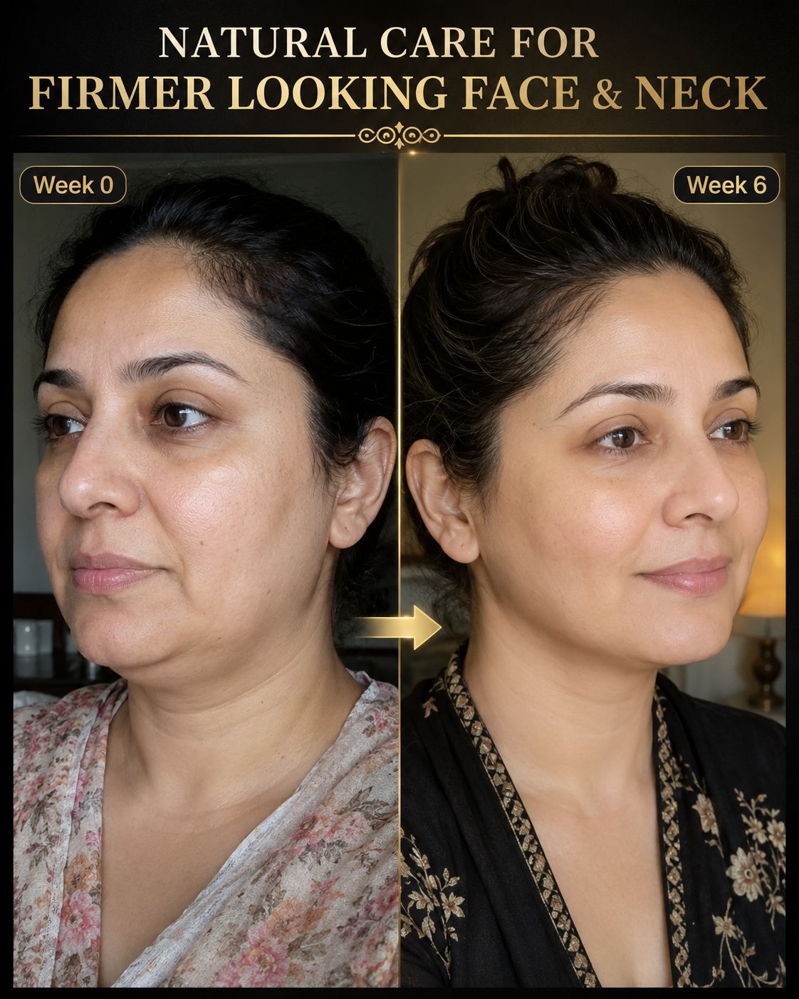 Natural Care for Firmer Looking Face and Neck – Effective Home Remedies for Skin Tightening