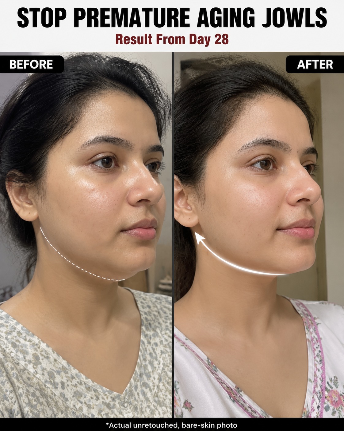 Stop Premature Aging Jowls Naturally: Proven Remedies to Tighten Jawline Skin in 28 Days