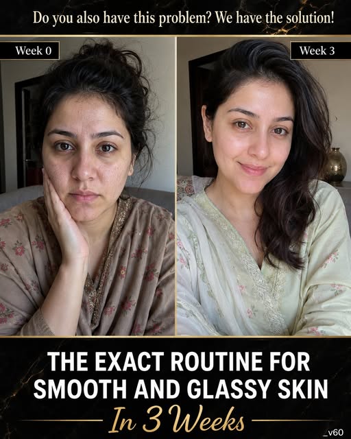 Get Smooth and Glassy Skin Naturally in 3 Weeks Using Proven Home Remedies