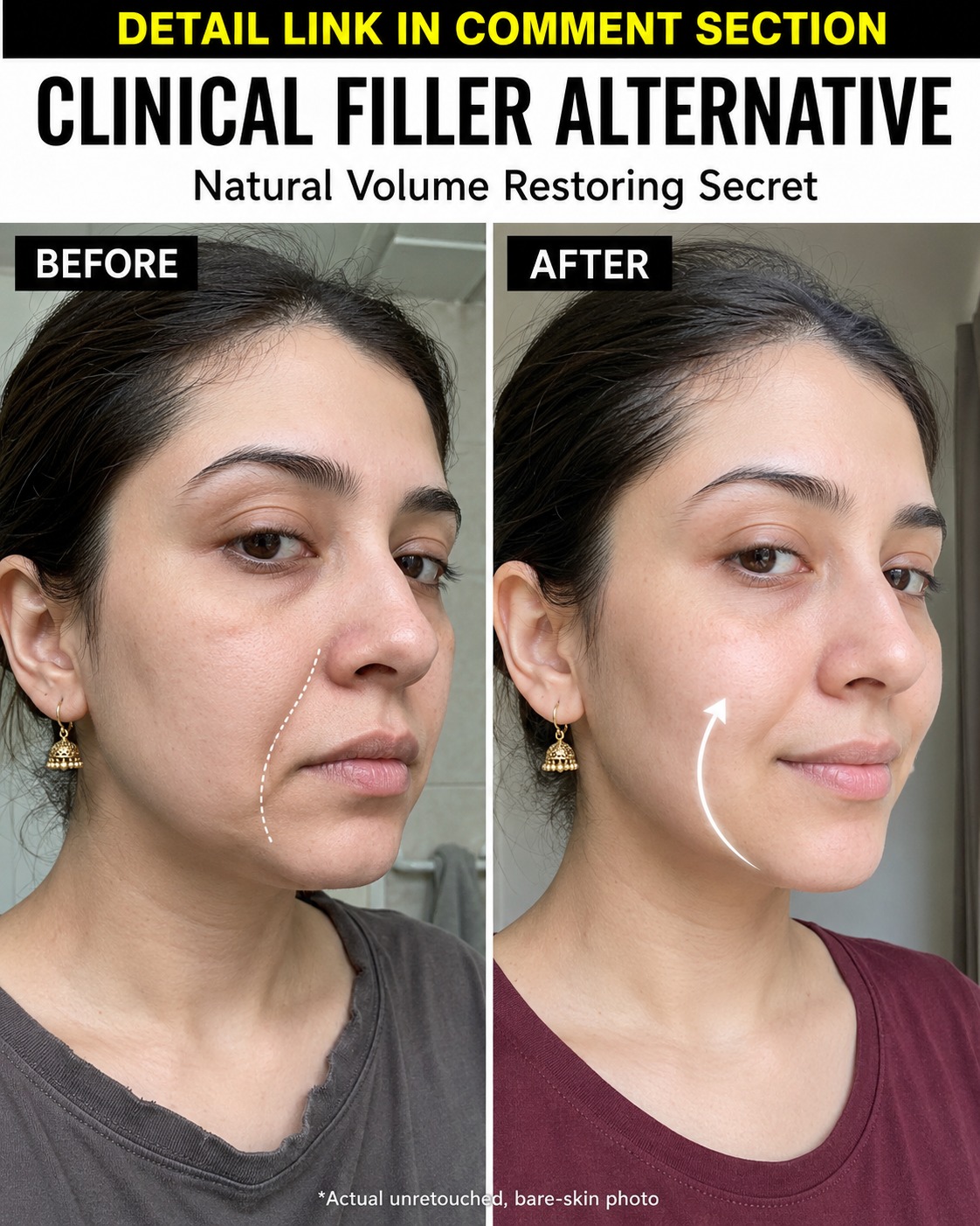 Natural Volume Restoring Remedies for Hollow and Sagging Skin