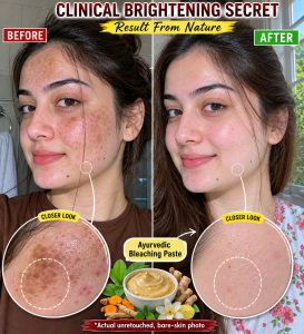 Clinical Brightening Secret: Natural Ayurvedic Paste for Pigmentation, Dark Spots, and Dull Skin
