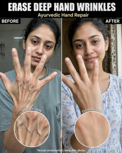 Erase Deep Hand Wrinkles Naturally with Ayurvedic Hand Repair