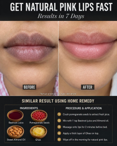 Get Natural Pink Lips Fast: Safe Home Remedies for Softer, Brighter Lips in 7 Days