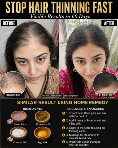 Stop Hair Thinning Fast: Visible Results in 60 Days Using Home Remedies