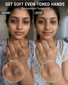 Get Soft Even-Toned Hands Naturally: Dermatologist-Inspired Acid Home Remedies by Skin Type