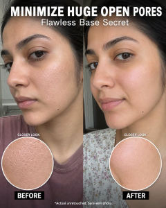 Minimize Huge Open Pores Naturally: Scientifically Supported Home Remedies for Every Skin Type