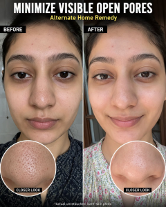 Minimize Visible Open Pores Naturally: Science-Backed Home Remedies for Every Skin Type