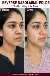 Reverse Nasolabial Folds Naturally: Visible Softening in 14 Days by Skin Type