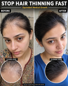 Stop Hair Thinning Fast Naturally: Evidence-Based Scalp Remedies for Fuller-Looking Hair