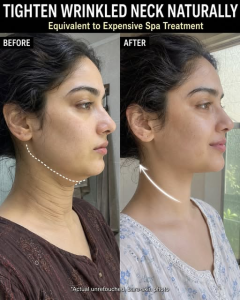 Tighten Wrinkled Neck Naturally: Evidence-Based Home Remedies by Skin Type