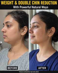 Weight & Double Chin Reduction with Powerful Natural Ways: A Complete Skin-Type Guide