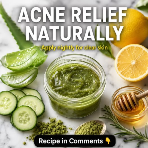 Acne Relief Naturally: Five Gentle Home Remedies for Clearer-Looking Skin