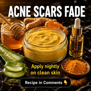 Acne Scars Fade Naturally: Evidence-Based Home Remedies for Clear, Smooth Skin