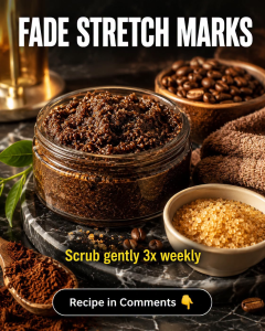 Fade Stretch Marks Naturally: 5 Gentle Skin-Type Remedies Without Harsh Coffee Scrubs