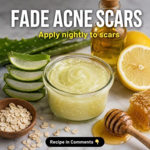How to Fade Acne Scars Naturally: Safe Remedies for Every Skin Type