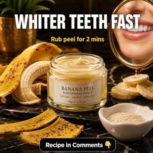 Whiten Teeth Safely at Home: Does Banana Peel Really Work?