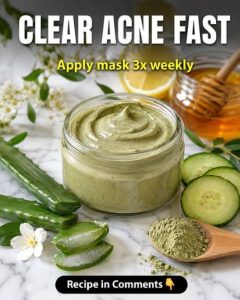 Clear Acne Naturally: Science-Backed Home Remedies for Healthy, Balanced Skin