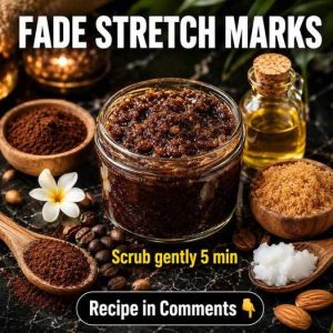Fade Stretch Marks Naturally: 5 Evidence-Informed Remedies by Skin Type